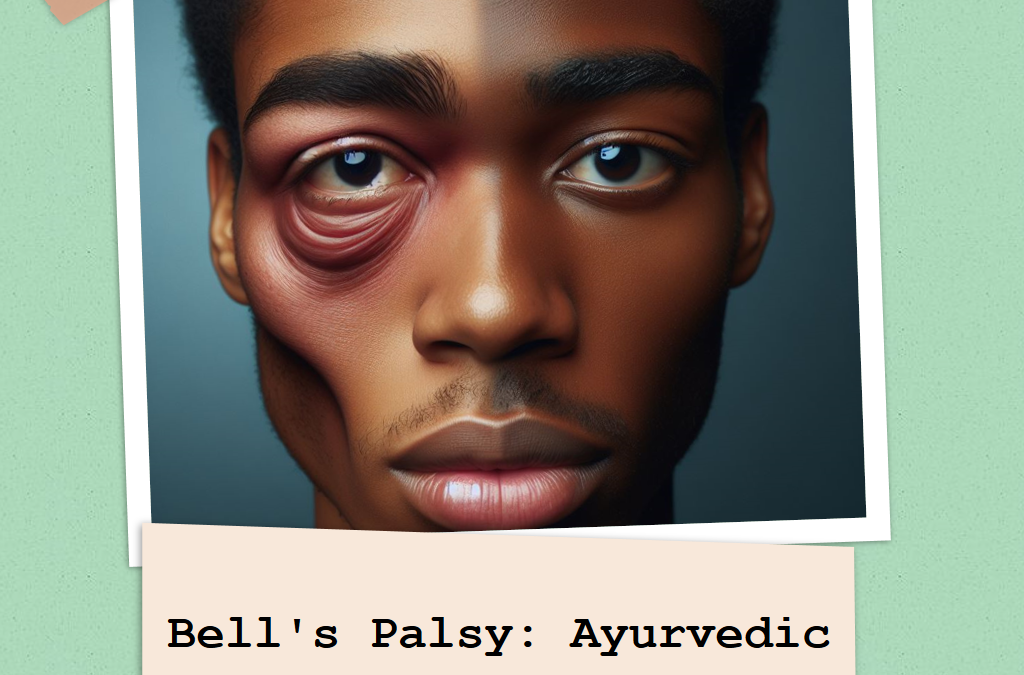 Bell’s Palsy: Ayurvedic Strategies for Facial Nerve Restoration